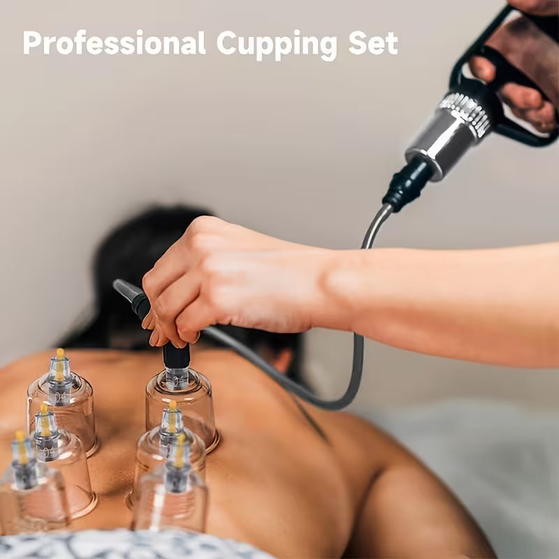 Cupping Set - 24PC